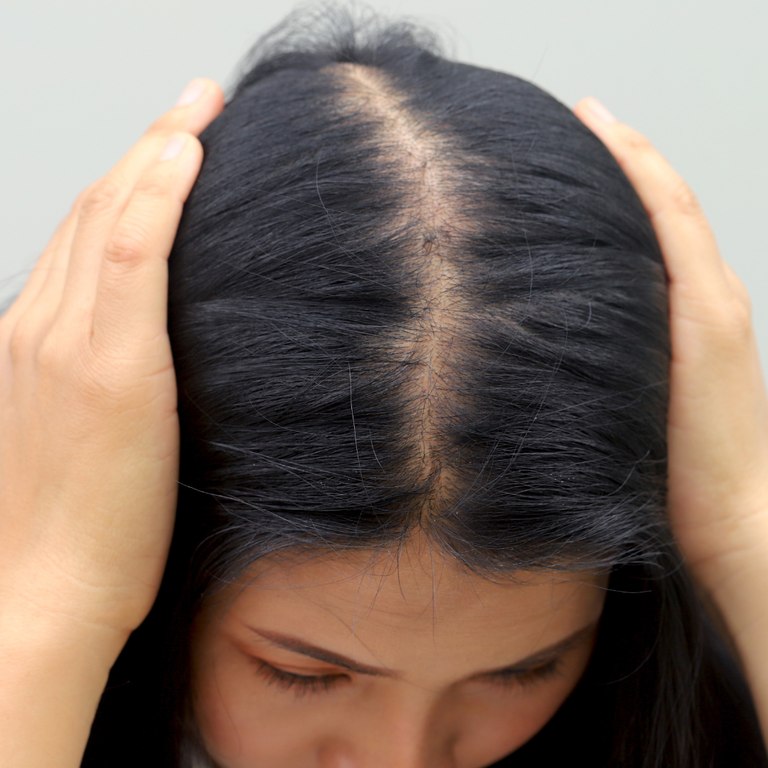 Dandruff & Scalp Treatment